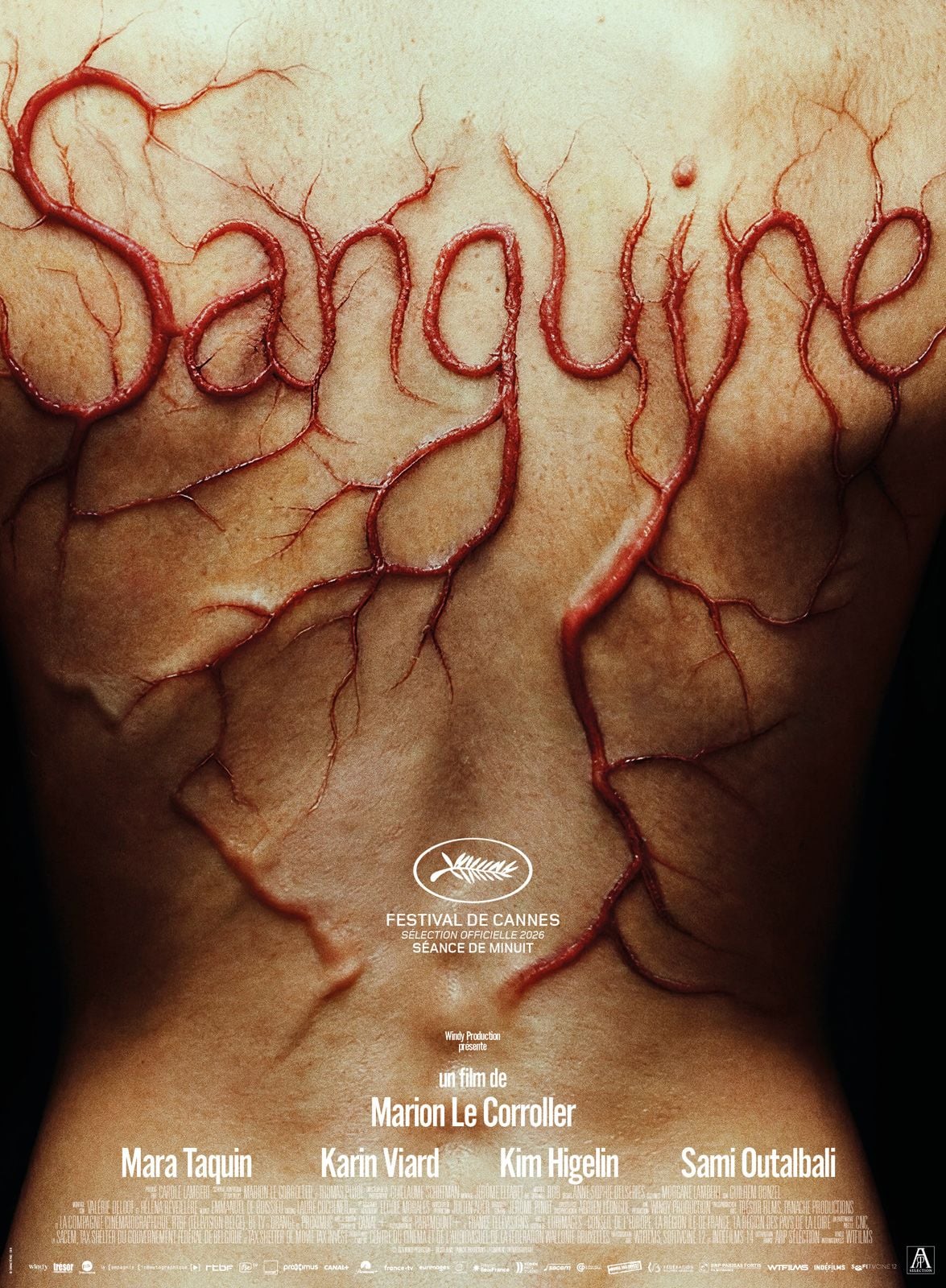 sanguine